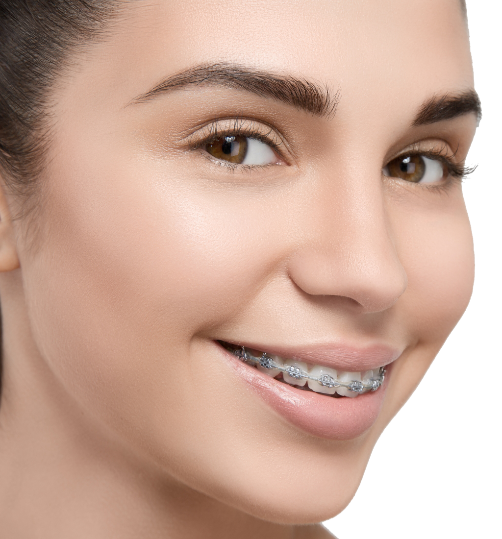360 orthodontics braces
